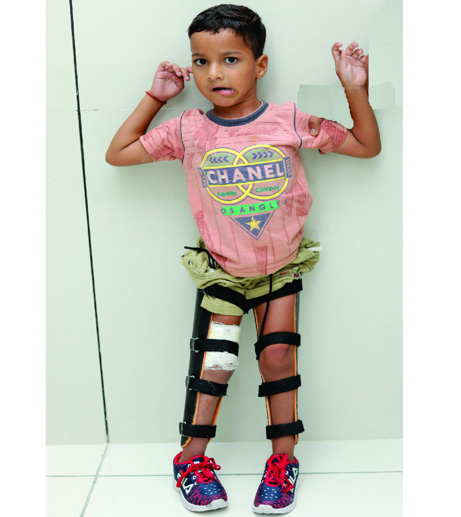 チャンドゥ・シークワル